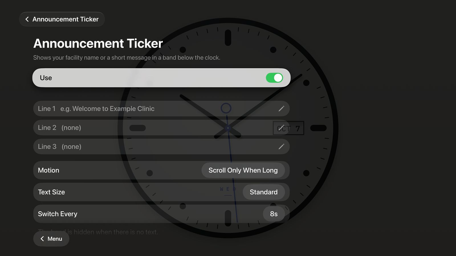 Announcement ticker settings